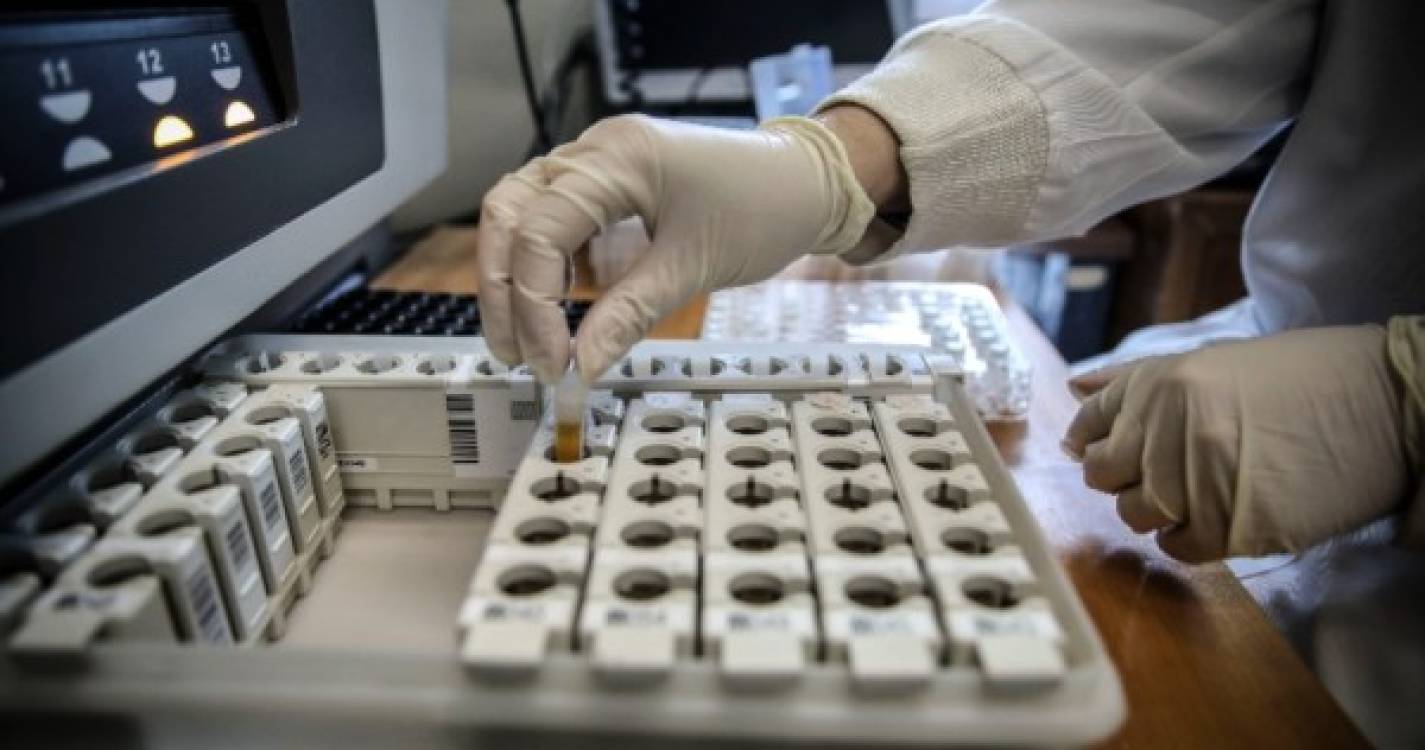 Portugal é o primeiro país a sequenciar o genoma do vírus Monkeypox