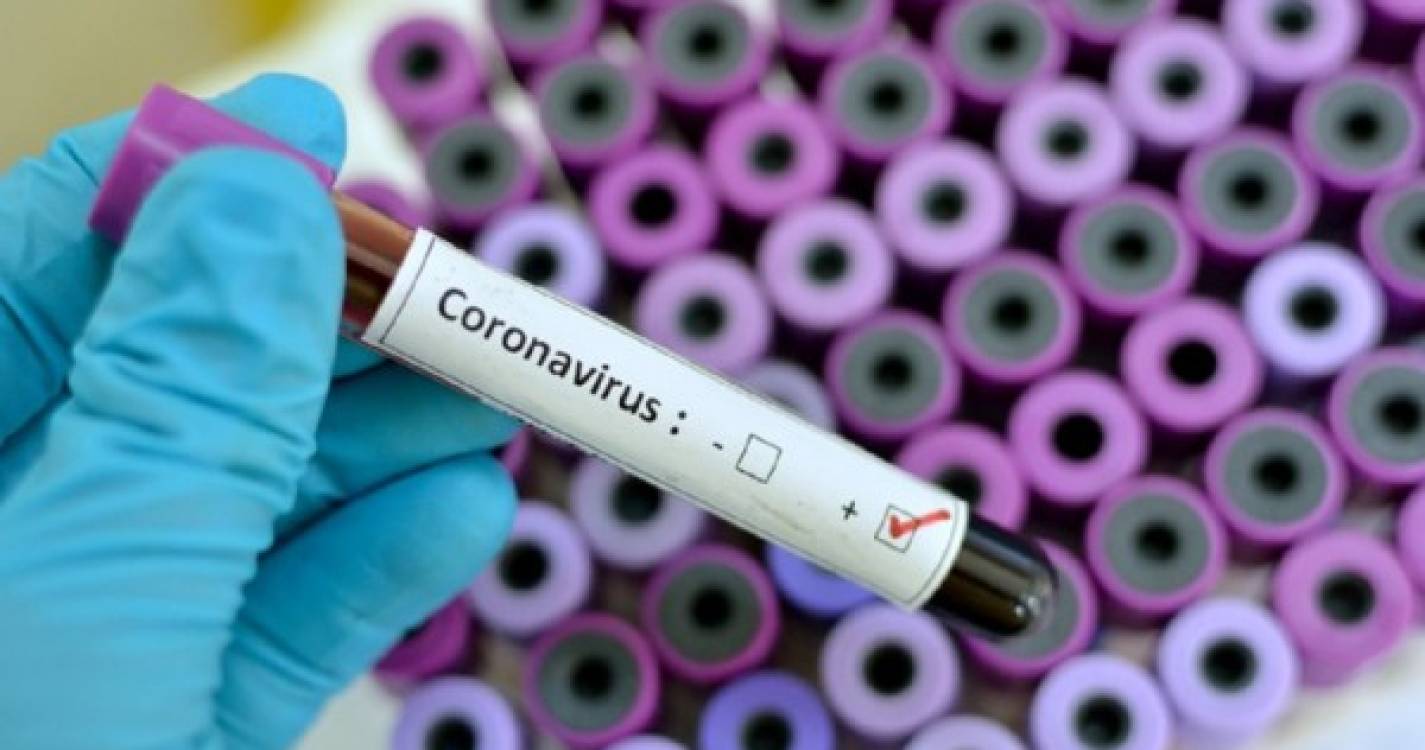 Covid-19: EUA ultrapassam marca de 20 milhões de casos desde o início da pandemia