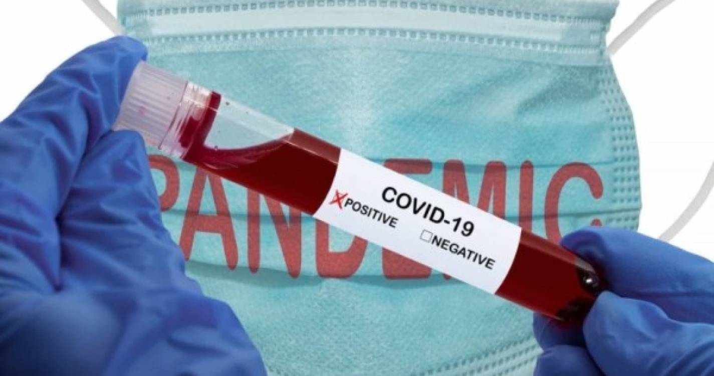 Covid-19: OMS insiste na necessidade de saber origem da pandemia