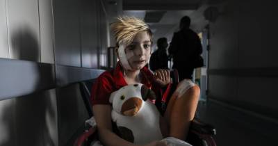 Criança ucrânia ferida num bombardeamento.
